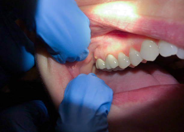 Best Urgent Dental Care in Richmond, MN