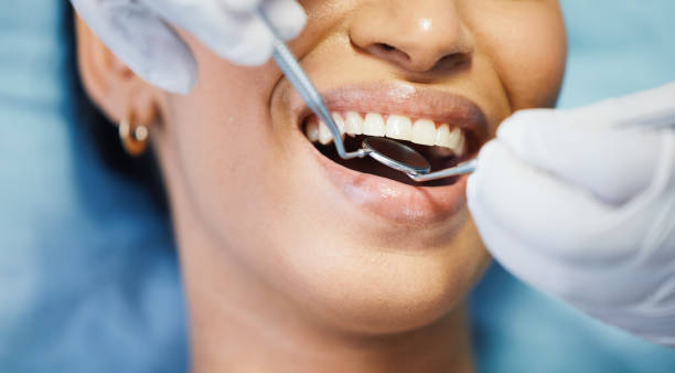 Best Emergency Root Canal Treatment in Richmond, MN